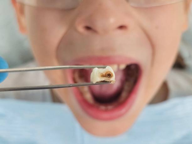 Best Same-Day Emergency Dentist in Perryville, AR